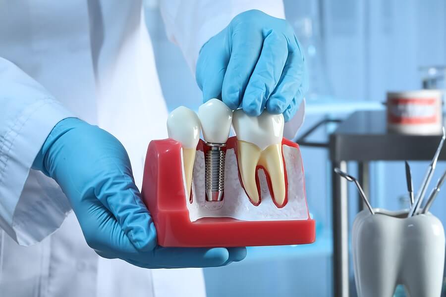 טיפול השתלת שיניים
