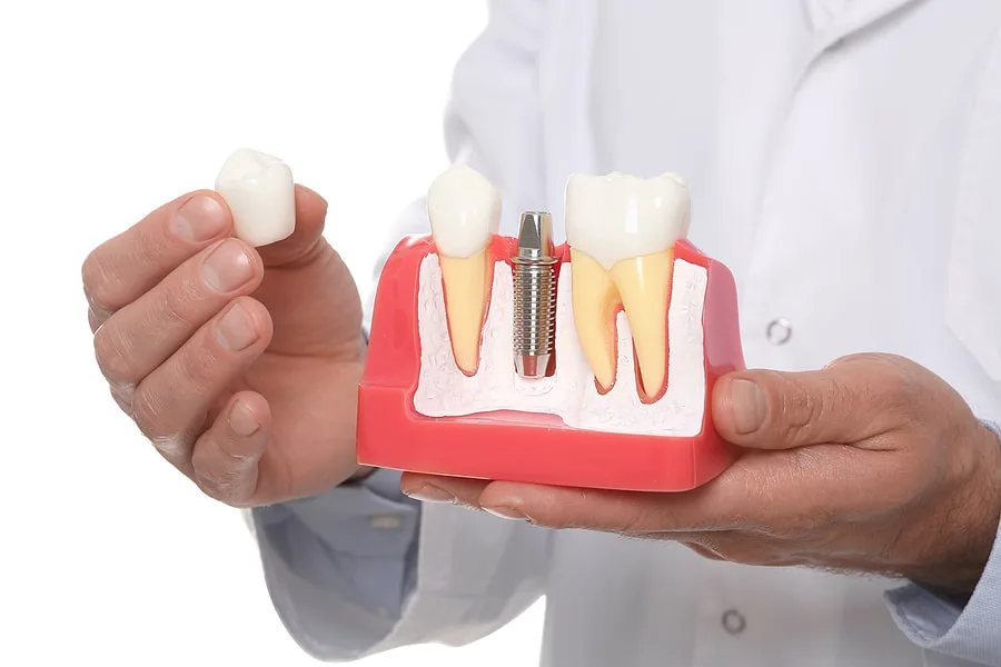 השתלות שיניים ברעננה